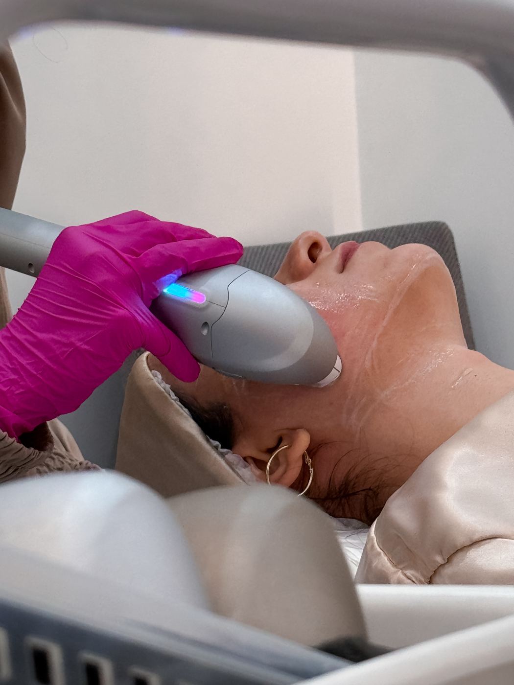 Sessão de Ultraformer® facial na Casa Moreira, em Moema